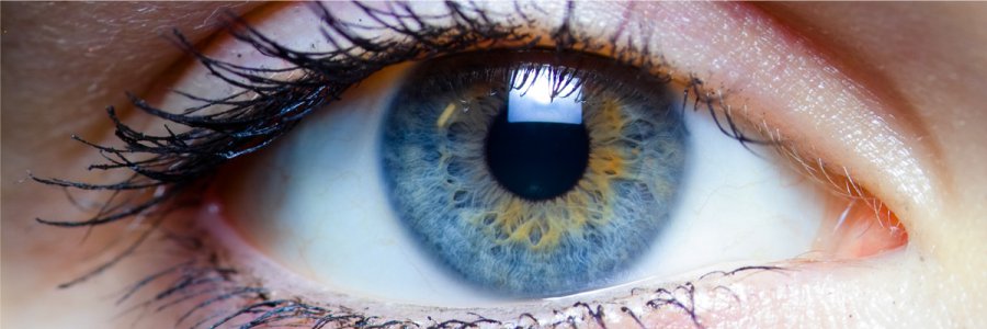 Il glaucoma: cos’è, quali sono i sintomi e come si cura